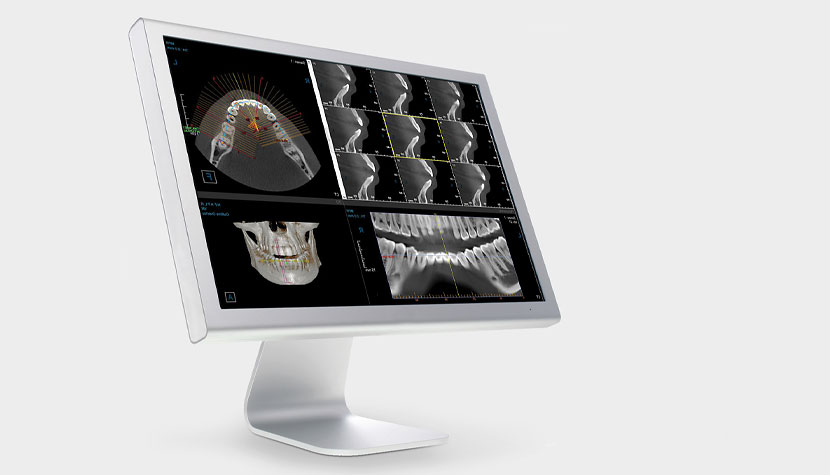 DVT / 3D-RÖNTGEN Dr. Seybold Augsburg